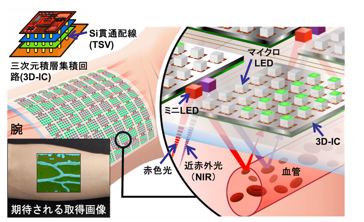 血管モニタリングシート (Smart Skin Display)(図)
